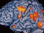 Ученые: Мозг человека способен самостоятельно излечиваться от шизофрении