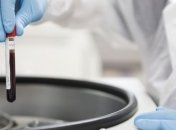 В МОЗе развенчали мифы о гемофилии