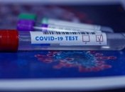 В Украине уже более 400 тысяч случаев коронавируса: статистика на 2 ноября