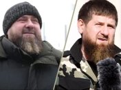 кадыров серьезно изменился за последний год (фото слева – нынешний внешний вид)