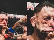 Фрэнки Эдгар после удара Марлона Вера