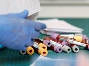 Сейчас нельзя протестировать всех украинцев на COVID-19: Биолог объяснил почему