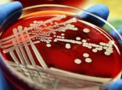 Создали первое в мире масло, способное убить смертельную бактерию 