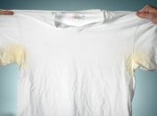 Пожелтения от пота особенно заметны на белой одежде