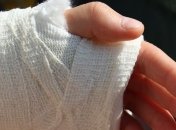 Стало известно, как тренировать сломанную руку 