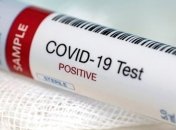 З майже 8 тисяч ІФА-тестів в Україні - 479 позитивні