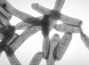 Бактерии легионеллы