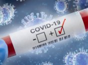 Украина второй день подряд бьет суточный рекорд смертности от COVID-19 с начала пандемии