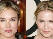 Пластика изменила Рене Зеллвегер до неузнаваемости.