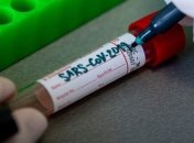 На Донбассе - новый случай инфицирования COVID-19