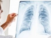 В Ивано-Франковске растет число больных пневмониями