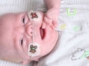 Чудо: младенец весом в 425 граммов выжил (Фото)