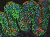 Ученые вырастили искусственные желудки 