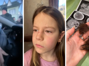 Избиение закончилось сотрясением мозга у матери и гематомами у ее дочери