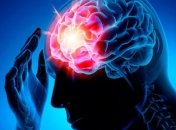 Генетика играет важную роль: ученые нашли новый ген, связанный с инсультом 