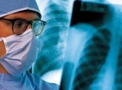 У сотрудницы одесской школы нашли туберкулез