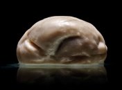 Обнаружен мозг без извилин