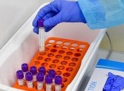 В Одесской области еще двое человек заразились коронавирусом