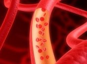 Эффективные средства для повышения гемоглобина 