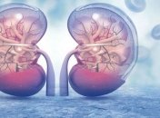 Главные признаки наличия камней в почках