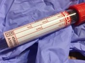 Новый анализ крови, который предсказывает риск смерти
