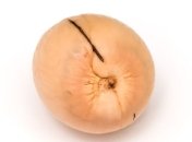 Как избавиться от келоидных рубцов у детей