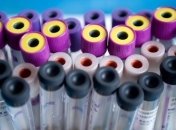 Изобретен новый метод диагностики рака