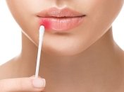 Медики придумали эффективный способ борьбы с вирусом герпеса