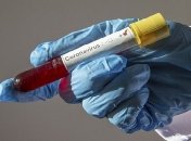 В Кременчуге выявили два новых случая COVID-19