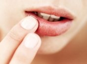 Эффективные средства для увлажнения сухих губ