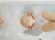 Умеренное многоводие при беременности