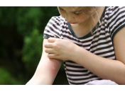 Зуд при укусе комаров: как облегчить состояние ребенка