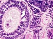 Ученые планируют создать искусственный яичник 