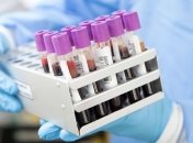 В Україні зареєстрували 1668 випадків коронавірусу, 52 летальних