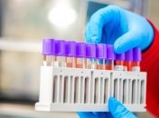 Київ, Харків, Одеса в лідерах - статистика COVID-19 в Україні