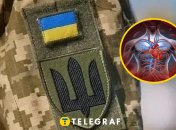 Ілюстративне зображення