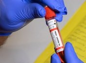 Коронавирус на Буковине: двое детей попали в реанимацию