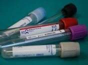 У місті Подільську зафіксували більще випадків коронавірусу, ніж в Одесі