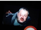 В Киеве на Лесном полтора часа насиловали несовершеннолетнюю (фото)