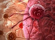 Биологами найдены негенетические причины развития рака