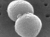 Ученые определили, как пневмококк вызывает болезни