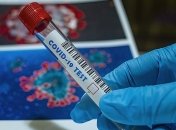 На Буковине - три новые жертвы COVID-19