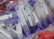 МОЗ визначиться з використанням тестів на антитіла