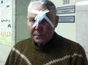 Еще 93 человека обратились в больницы после падения метеорита