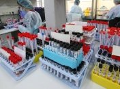 На Чернігівщині кількість хворих на коронавірус зросла до 177-ми