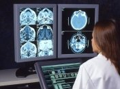 Ученые нашли в мозге человека механизм, который отключает удовольствия