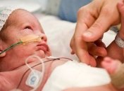 Ученые изобрели аппарат для недоношенных малышей