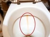 Как отчистить желтую полоску в унитазе - простой способ