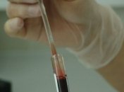 У світі зареєстрували понад 6 тисяч випадків нового коронавірусу