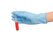 Изобретен анализ на продолжительность жизни